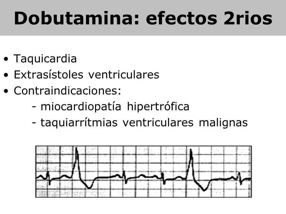 Dobutamina: efectos 2rios