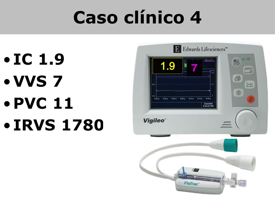 Caso clínico 4 IC 1.9 VVS 7 PVC 11 IRVS