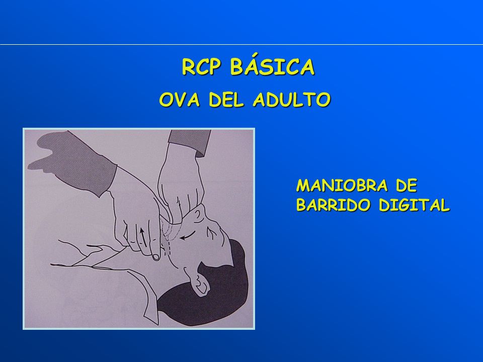 RCP BÁSICA OVA DEL ADULTO MANIOBRA DE BARRIDO DIGITAL