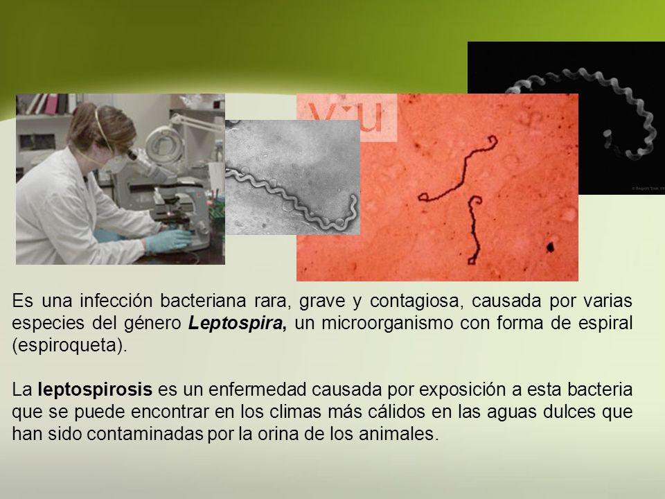 Es una infección bacteriana rara, grave y contagiosa, causada por varias especies del género Leptospira, un microorganismo con forma de espiral (espiroqueta).
