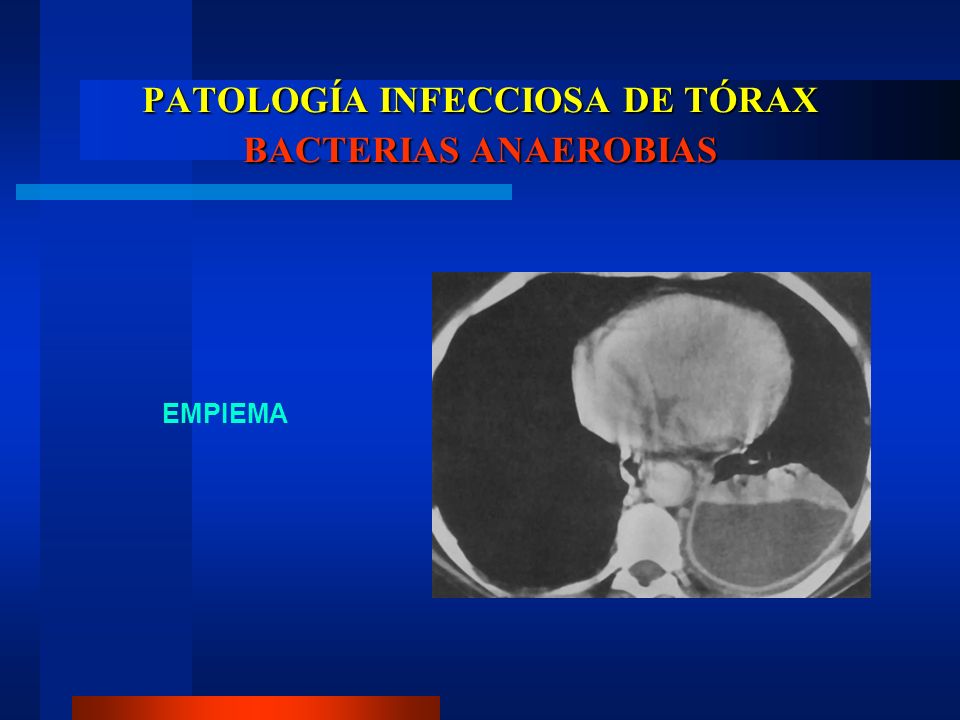PATOLOGÍA INFECCIOSA DE TÓRAX BACTERIAS ANAEROBIAS