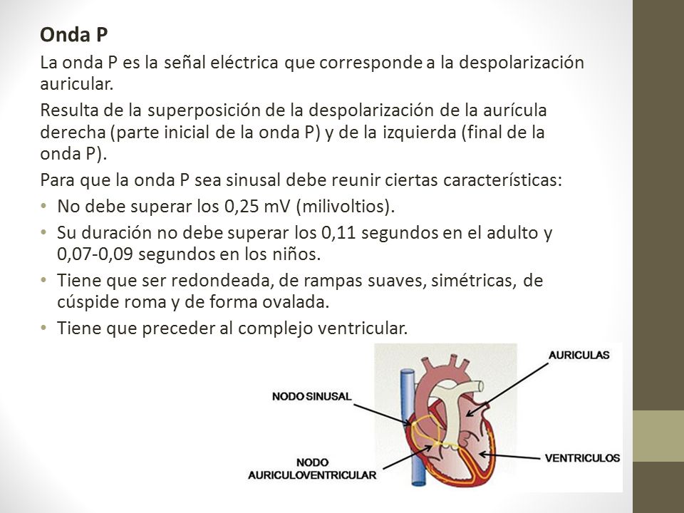 Onda P La onda P es la señal eléctrica que corresponde a la despolarización auricular.