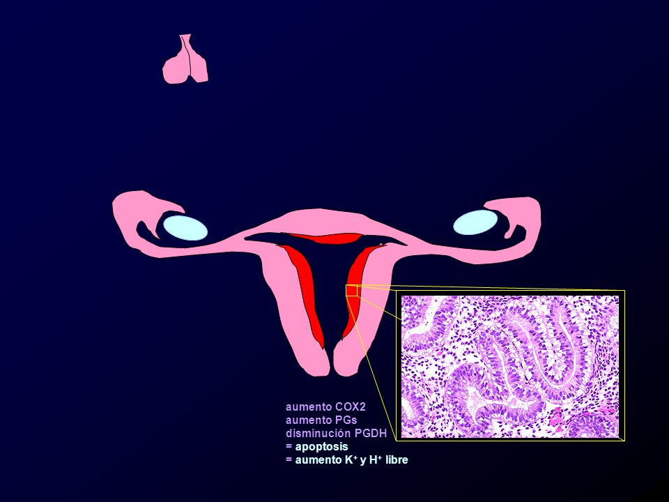 aumento COX2 aumento PGs disminución PGDH = apoptosis = aumento K+ y H+ libre