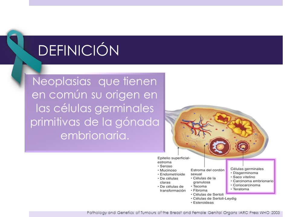 DEFINICIÓN Neoplasias que tienen en común su origen en las células germinales primitivas de la gónada embrionaria.