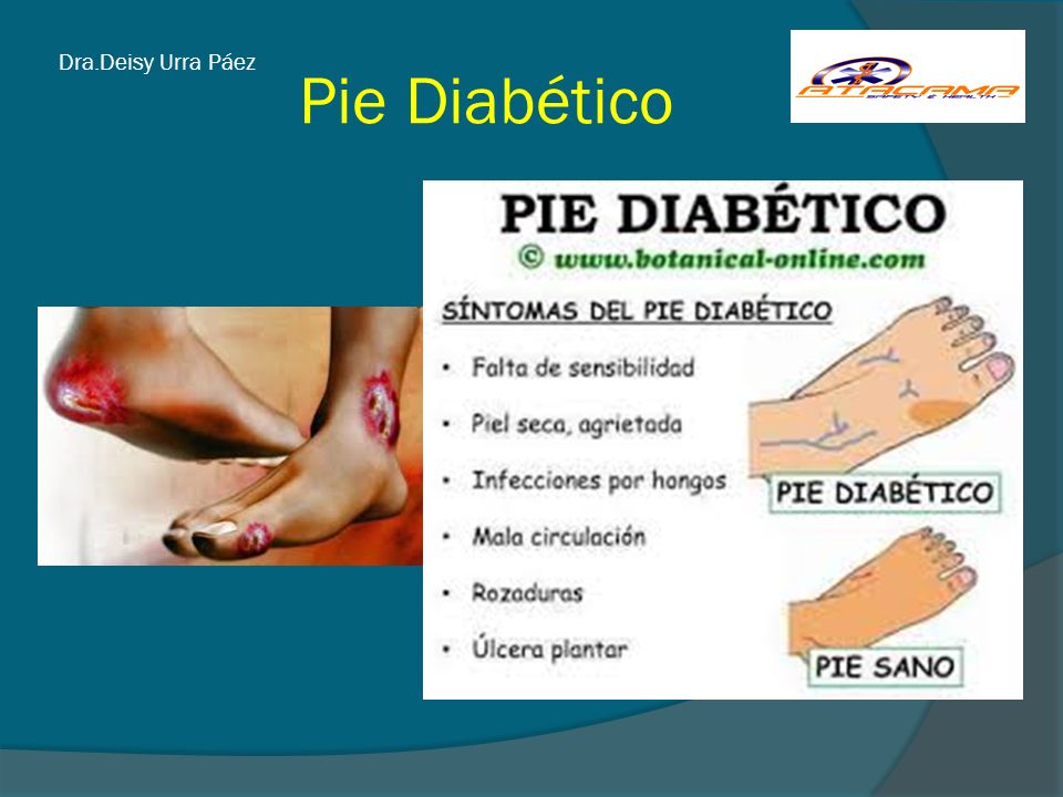 Dra.Deisy Urra Páez Pie Diabético