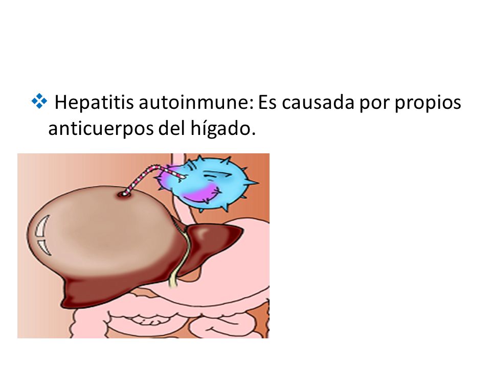Hepatitis autoinmune: Es causada por propios anticuerpos del hígado.