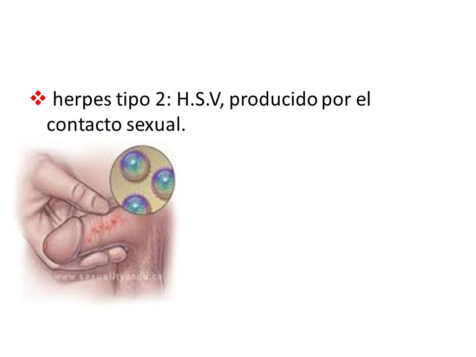 herpes tipo 2: H.S.V, producido por el contacto sexual.