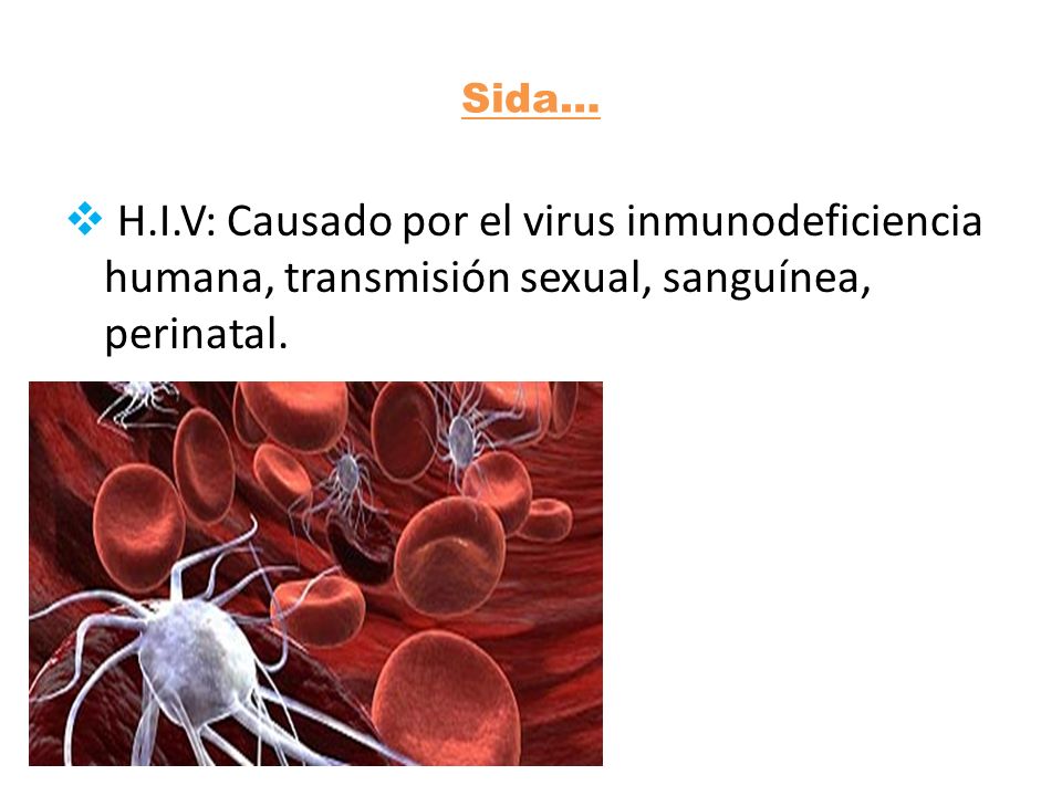 Sida… H.I.V: Causado por el virus inmunodeficiencia humana, transmisión sexual, sanguínea, perinatal.