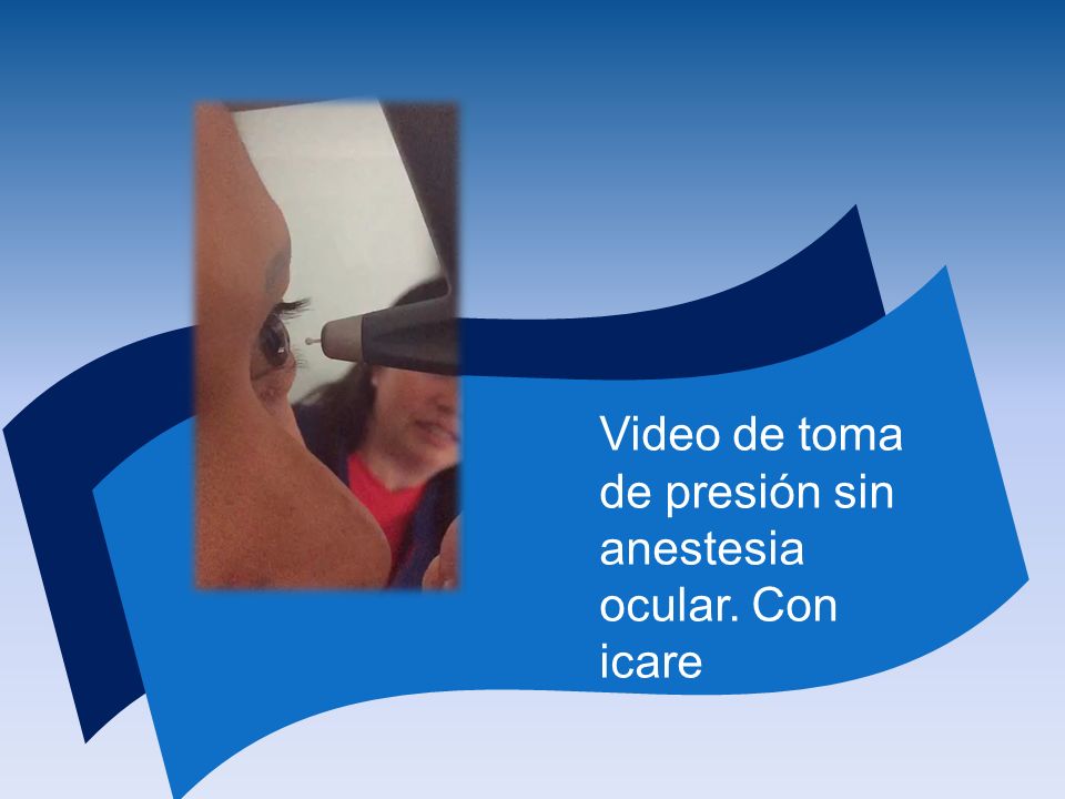 Video de toma de presión sin anestesia ocular. Con icare