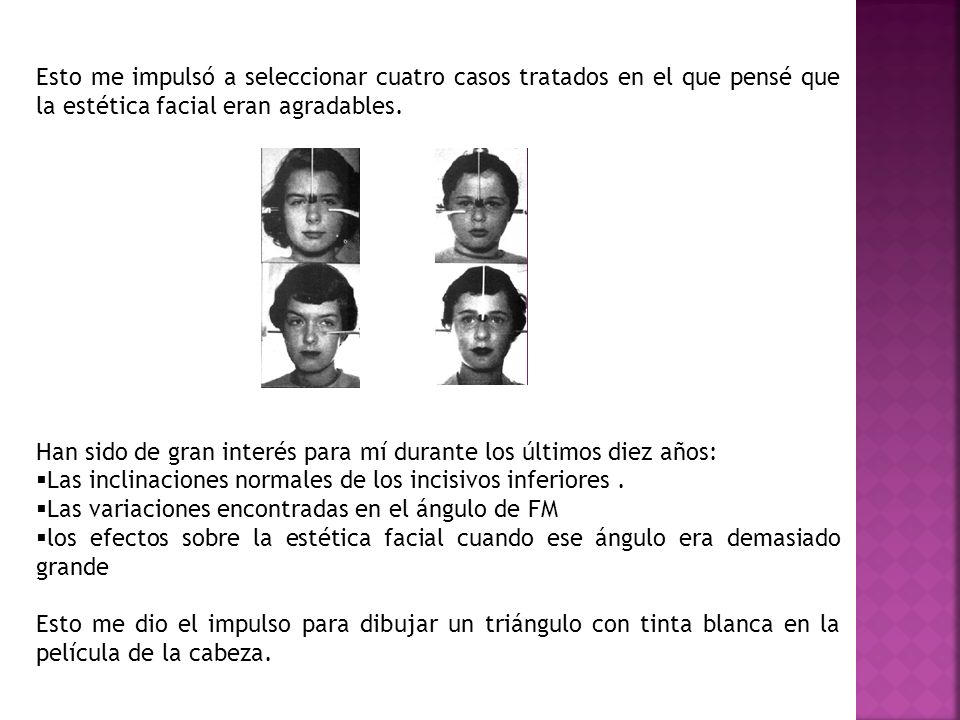Esto me impulsó a seleccionar cuatro casos tratados en el que pensé que la estética facial eran agradables.