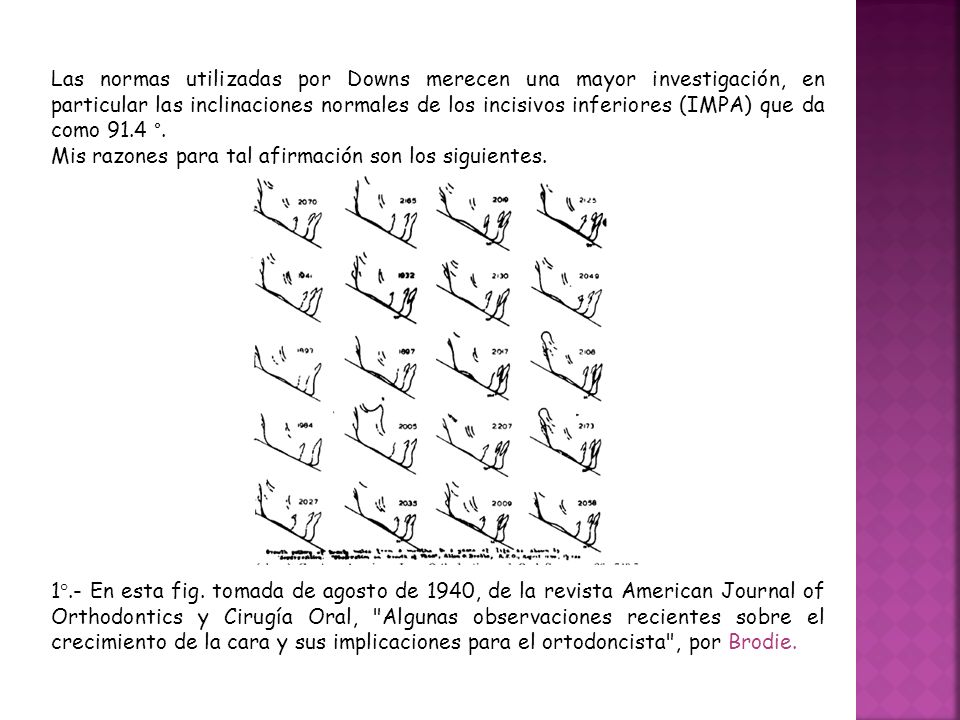 Las normas utilizadas por Downs merecen una mayor investigación, en particular las inclinaciones normales de los incisivos inferiores (IMPA) que da como 91.4 °.