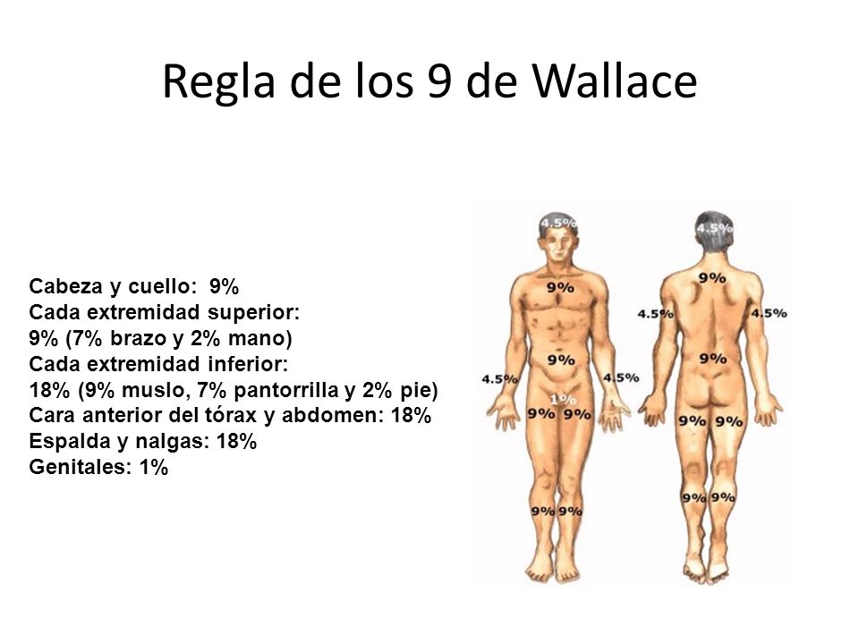Regla de los 9 de Wallace Cabeza y cuello: 9%