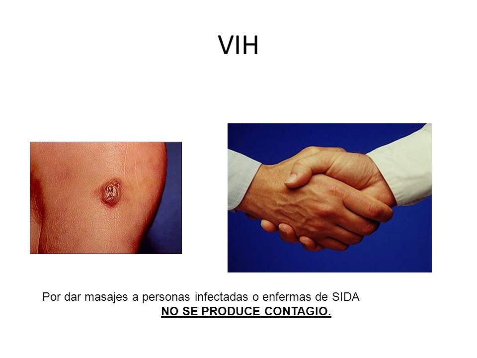 VIH Por dar masajes a personas infectadas o enfermas de SIDA