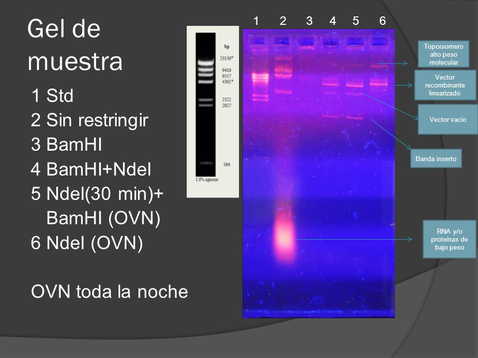 Gel de muestra 1 Std 2 Sin restringir 3 BamHI 4 BamHI+NdeI