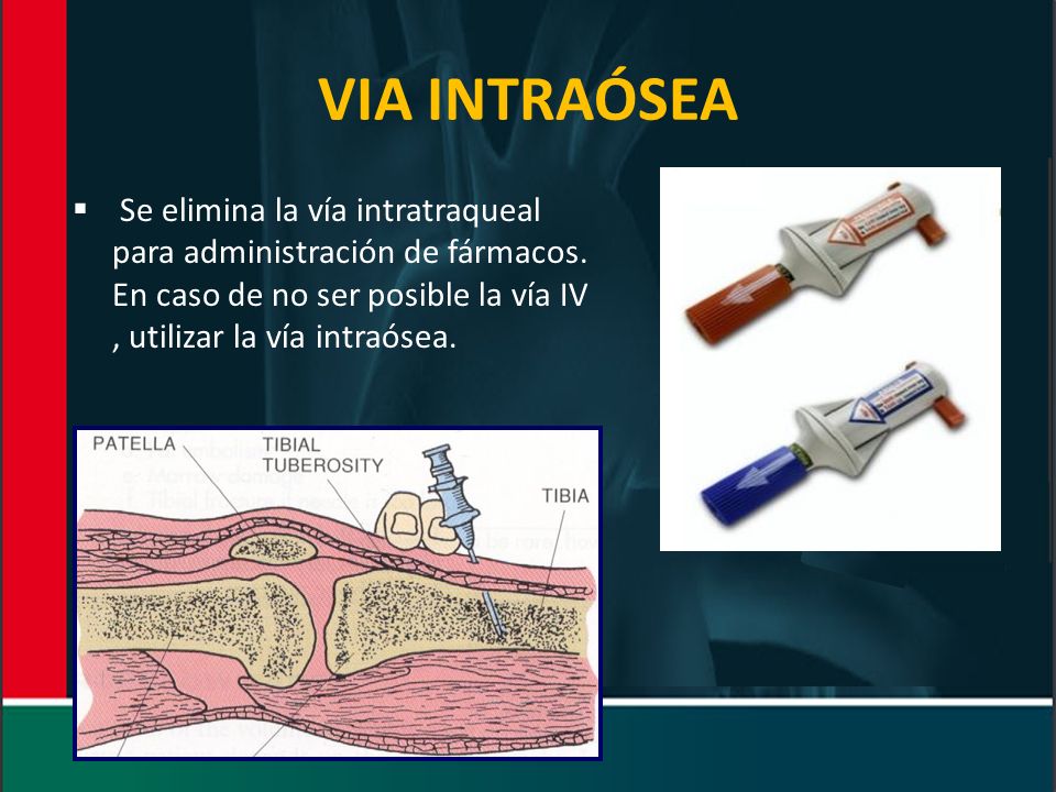 VIA INTRAÓSEA Se elimina la vía intratraqueal para administración de fármacos.