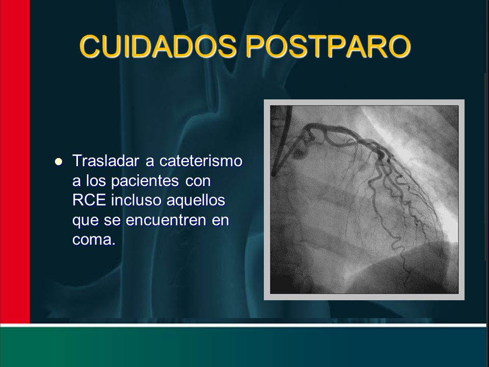 CUIDADOS POSTPARO Trasladar a cateterismo a los pacientes con RCE incluso aquellos que se encuentren en coma.
