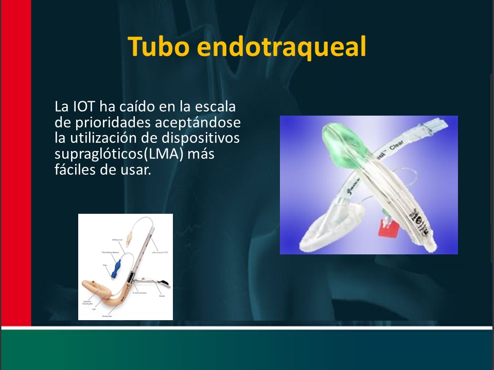 Tubo endotraqueal La IOT ha caído en la escala de prioridades aceptándose la utilización de dispositivos supraglóticos(LMA) más fáciles de usar.