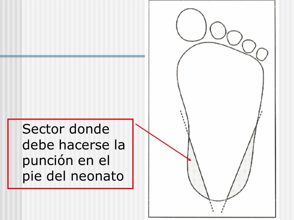 Sector donde debe hacerse la punción en el pie del neonato