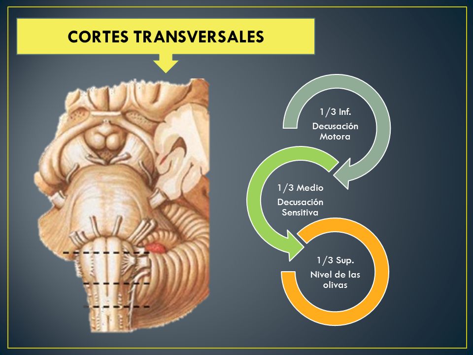CORTES TRANSVERSALES 1/3 Medio Decusación Sensitiva 1/3 Sup.