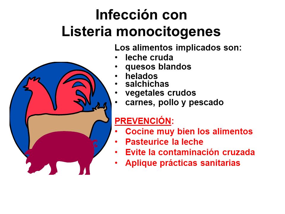 Infección con Listeria monocitogenes
