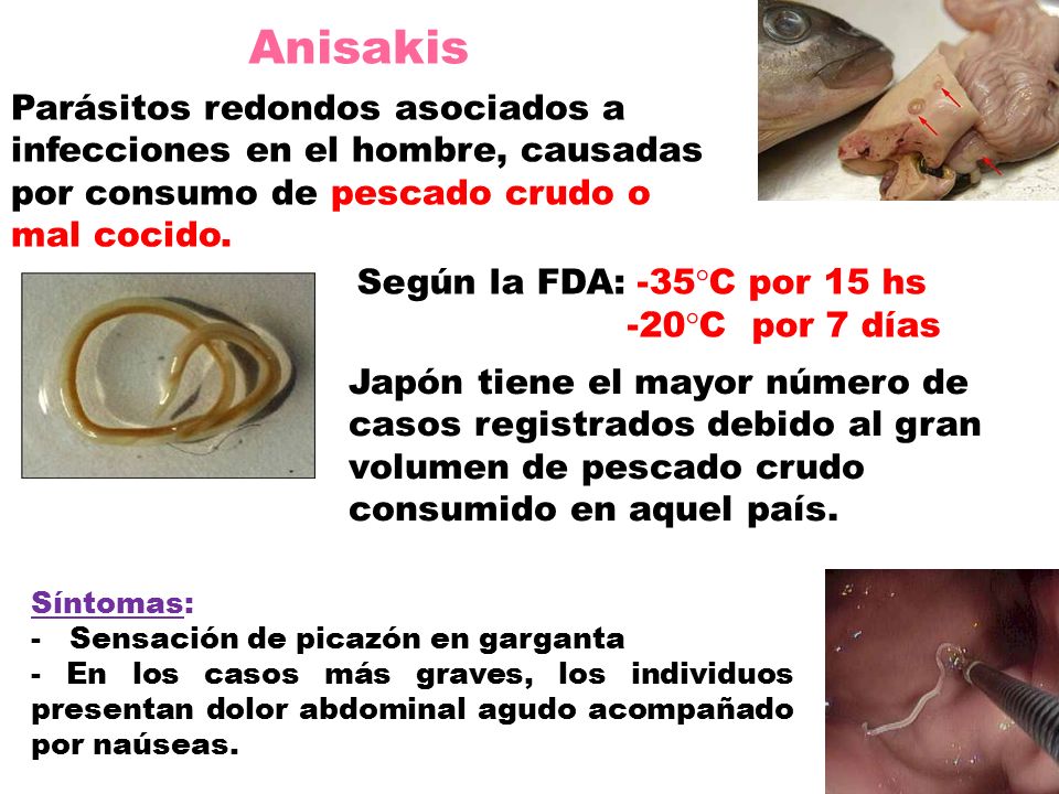 Anisakis Parásitos redondos asociados a infecciones en el hombre, causadas por consumo de pescado crudo o mal cocido.