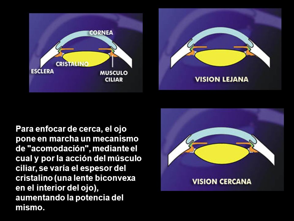 Para enfocar de cerca, el ojo pone en marcha un mecanismo de acomodación , mediante el cual y por la acción del músculo ciliar, se varía el espesor del cristalino (una lente biconvexa en el interior del ojo), aumentando la potencia del mismo.