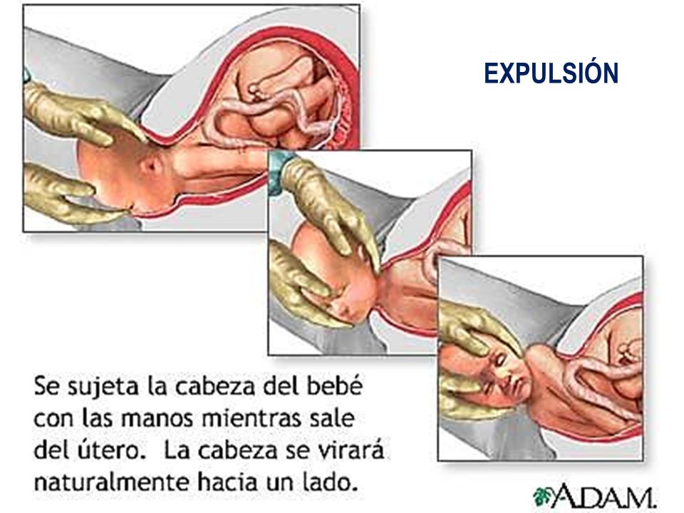 EXPULSIÓN