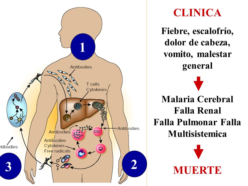 CLINICA. Fiebre, escalofrío, dolor de cabeza, vomito, malestar general.