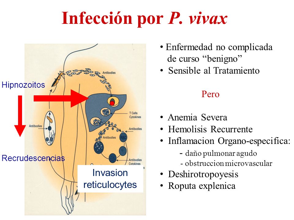 Infección por P. vivax Enfermedad no complicada de curso benigno