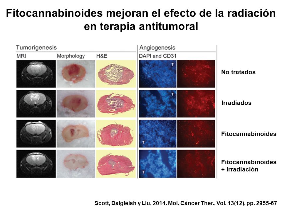 Fitocannabinoides mejoran el efecto de la radiación en terapia antitumoral