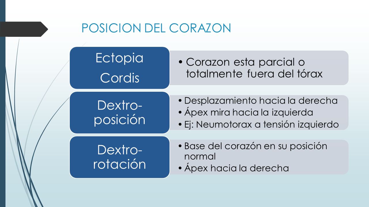 Ectopia Cordis Dextro-posición Dextro- rotación POSICION DEL CORAZON