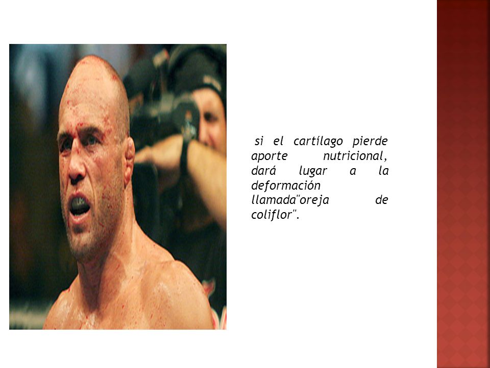 si el cartílago pierde aporte nutricional, dará lugar a la deformación llamada oreja de coliflor .