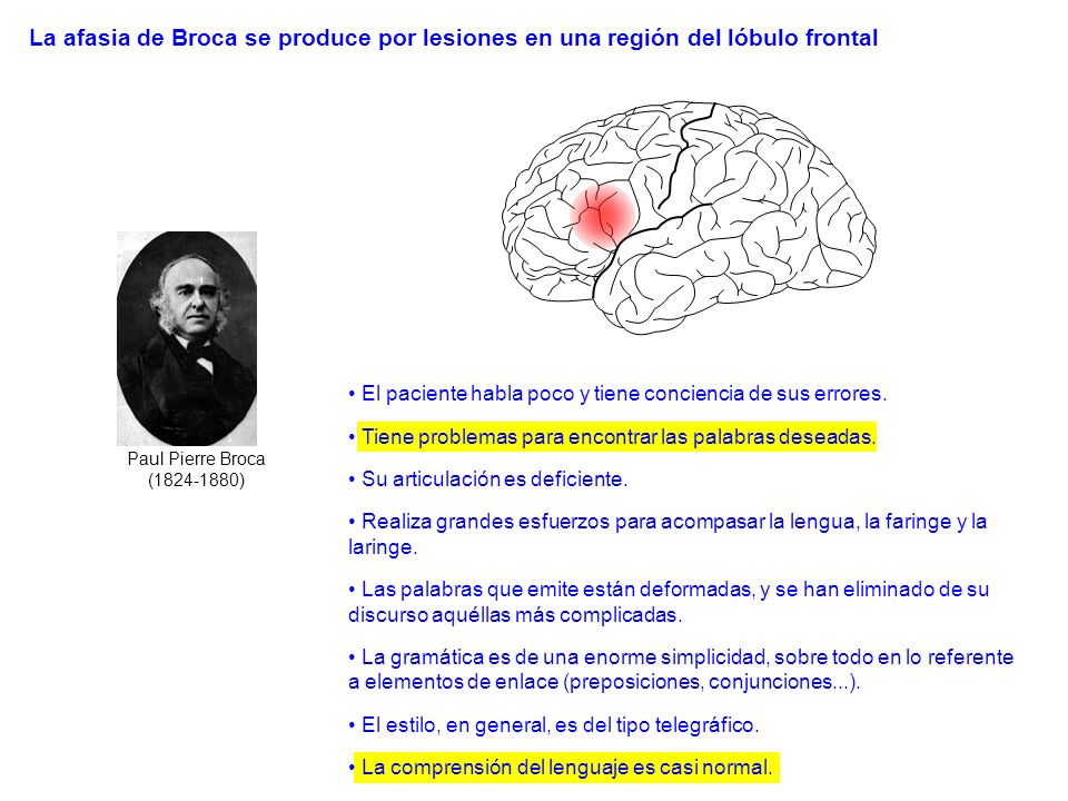 La afasia de Broca se produce por lesiones en una región del lóbulo frontal