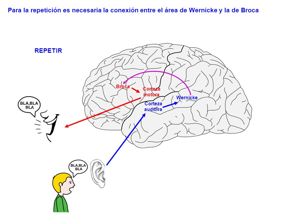 Para la repetición es necesaria la conexión entre el área de Wernicke y la de Broca
