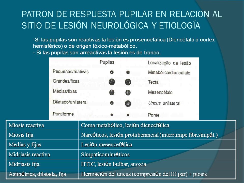 PATRON DE RESPUESTA PUPILAR EN RELACION AL SITIO DE LESIÓN NEUROLÓGICA Y ETIOLOGÍA