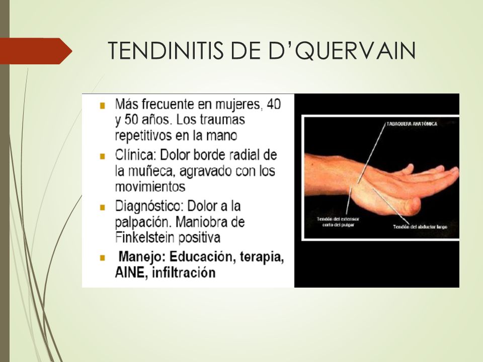 TENDINITIS DE D’QUERVAIN