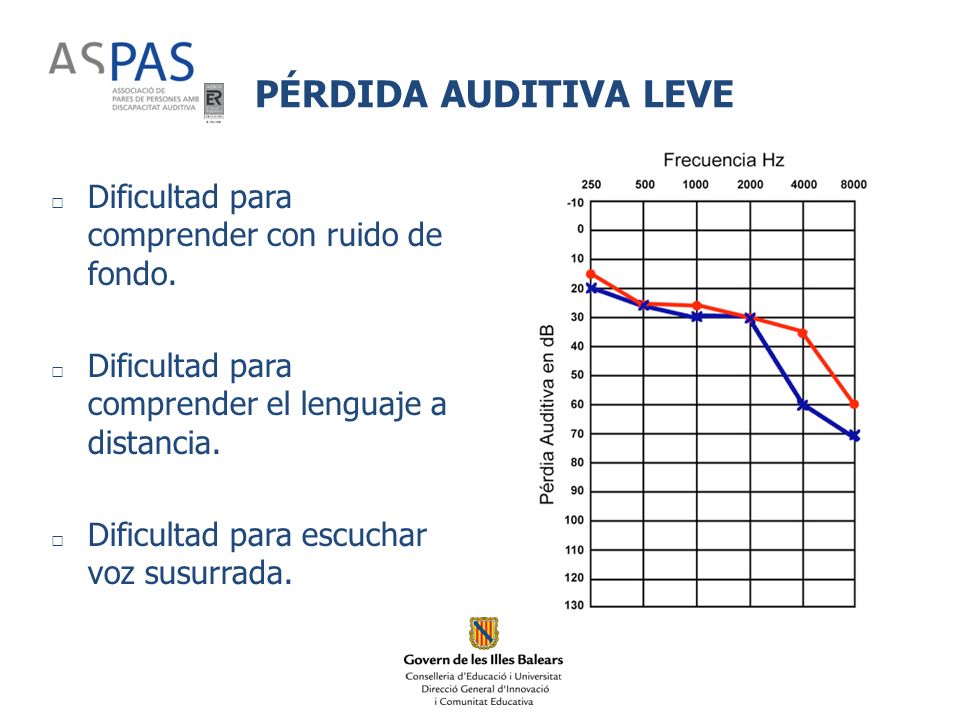 PÉRDIDA AUDITIVA LEVE Dificultad para comprender con ruido de fondo.
