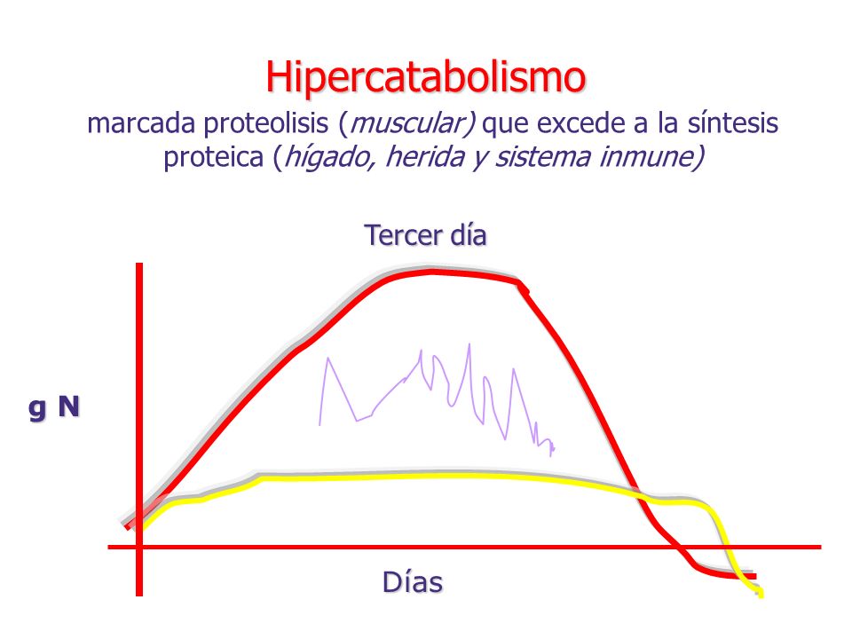 Hipercatabolismo marcada proteolisis (muscular) que excede a la síntesis proteica (hígado, herida y sistema inmune)