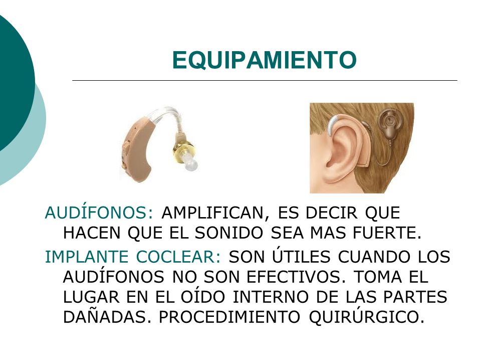 EQUIPAMIENTO AUDÍFONOS: AMPLIFICAN, ES DECIR QUE HACEN QUE EL SONIDO SEA MAS FUERTE.