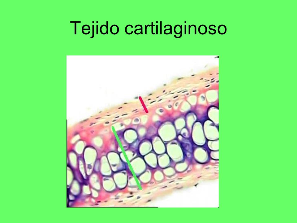 Tejido cartilaginoso