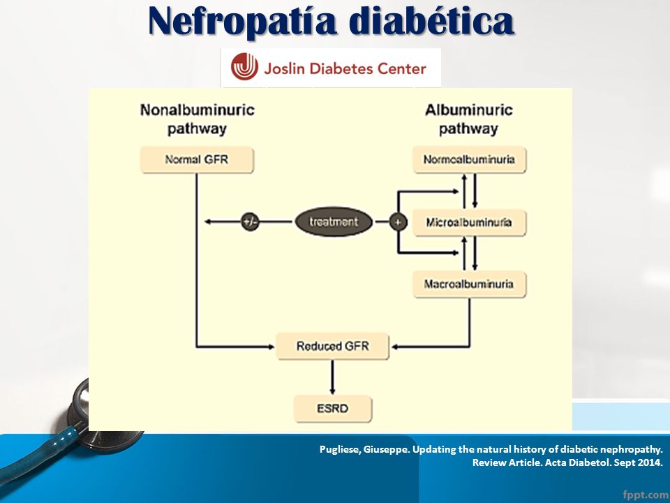 Nefropatía diabética Pugliese, Giuseppe. Updating the natural history of diabetic nephropathy.