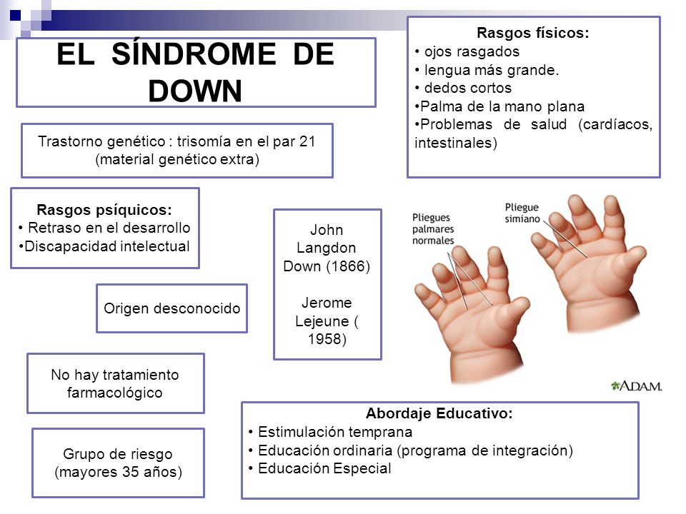 EL SÍNDROME DE DOWN Rasgos físicos: ojos rasgados lengua más grande.