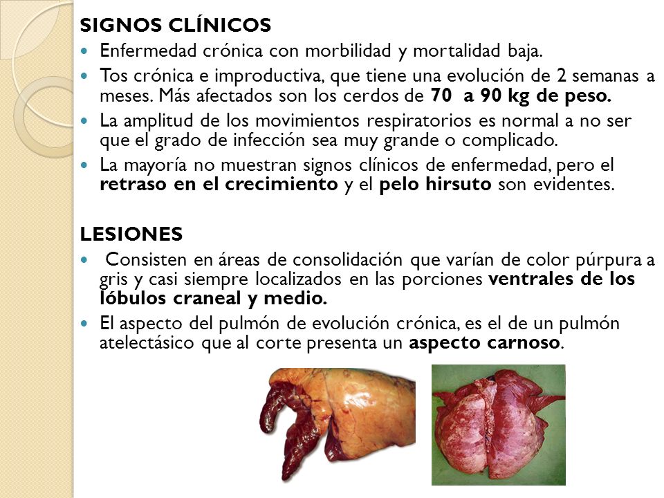 Signos clínicos Enfermedad crónica con morbilidad y mortalidad baja.