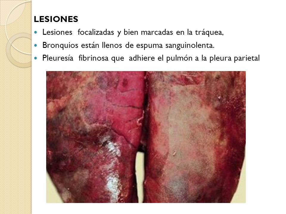 Lesiones Lesiones focalizadas y bien marcadas en la tráquea, Bronquios están llenos de espuma sanguinolenta.