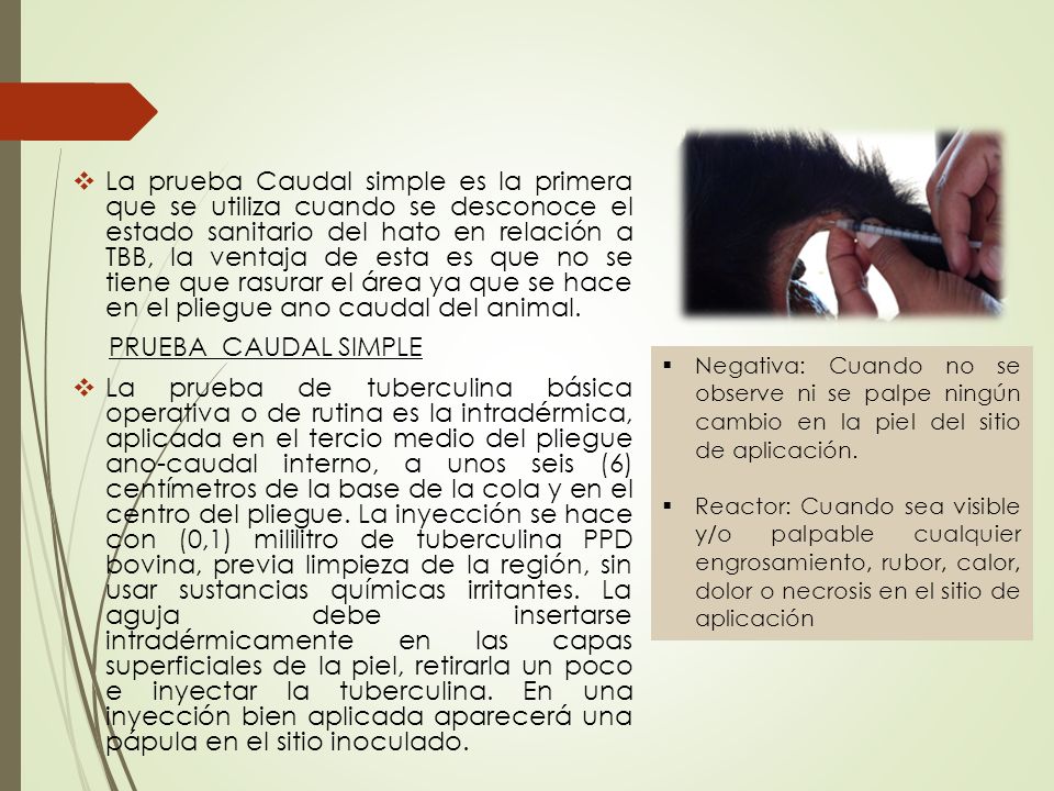 La prueba Caudal simple es la primera que se utiliza cuando se desconoce el estado sanitario del hato en relación a TBB, la ventaja de esta es que no se tiene que rasurar el área ya que se hace en el pliegue ano caudal del animal.