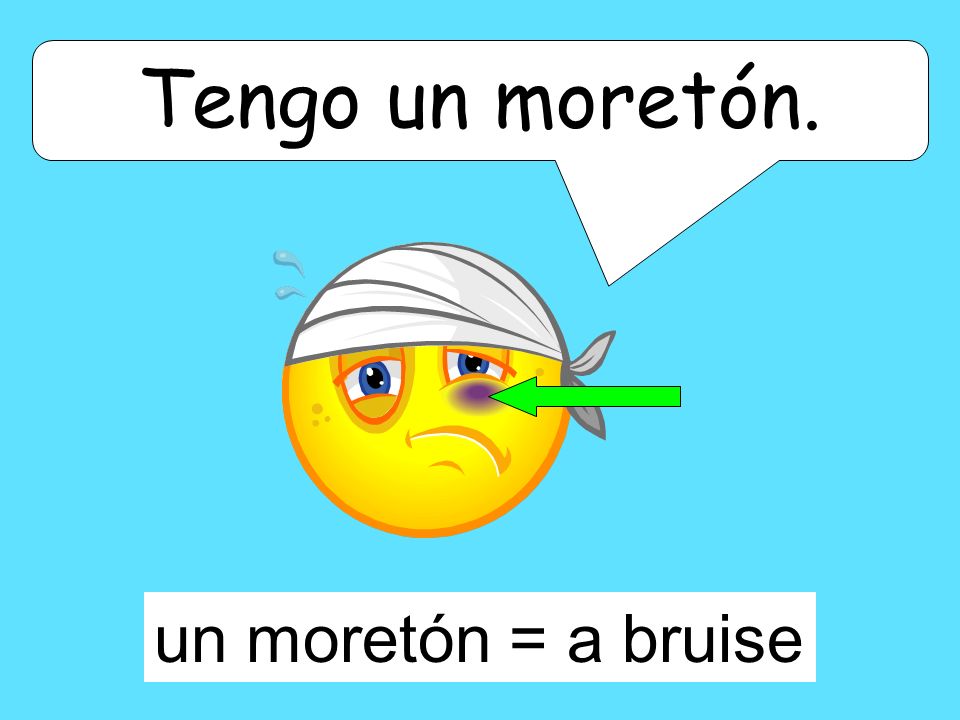 Tengo un moretón. un moretón = a bruise
