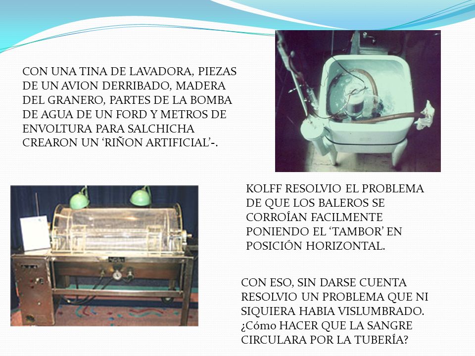 CON UNA TINA DE LAVADORA, PIEZAS DE UN AVION DERRIBADO, MADERA DEL GRANERO, PARTES DE LA BOMBA DE AGUA DE UN FORD Y METROS DE ENVOLTURA PARA SALCHICHA CREARON UN ‘RIÑON ARTIFICIAL’-.