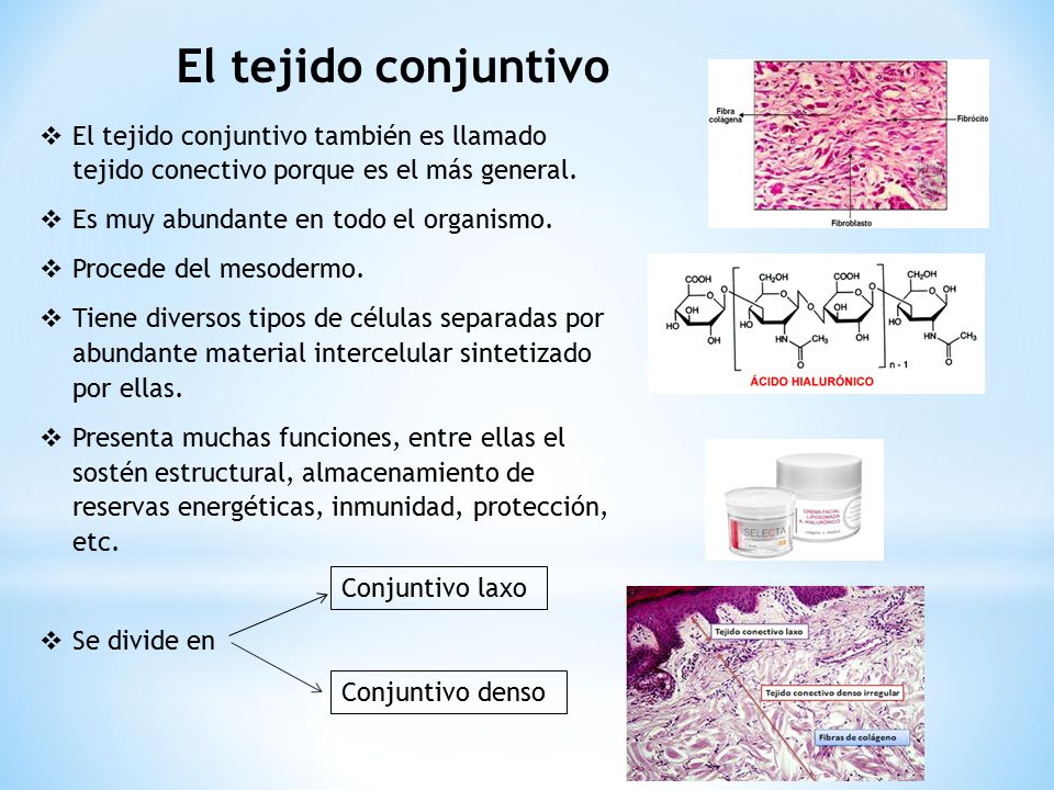 El tejido conjuntivo El tejido conjuntivo también es llamado tejido conectivo porque es el más general.