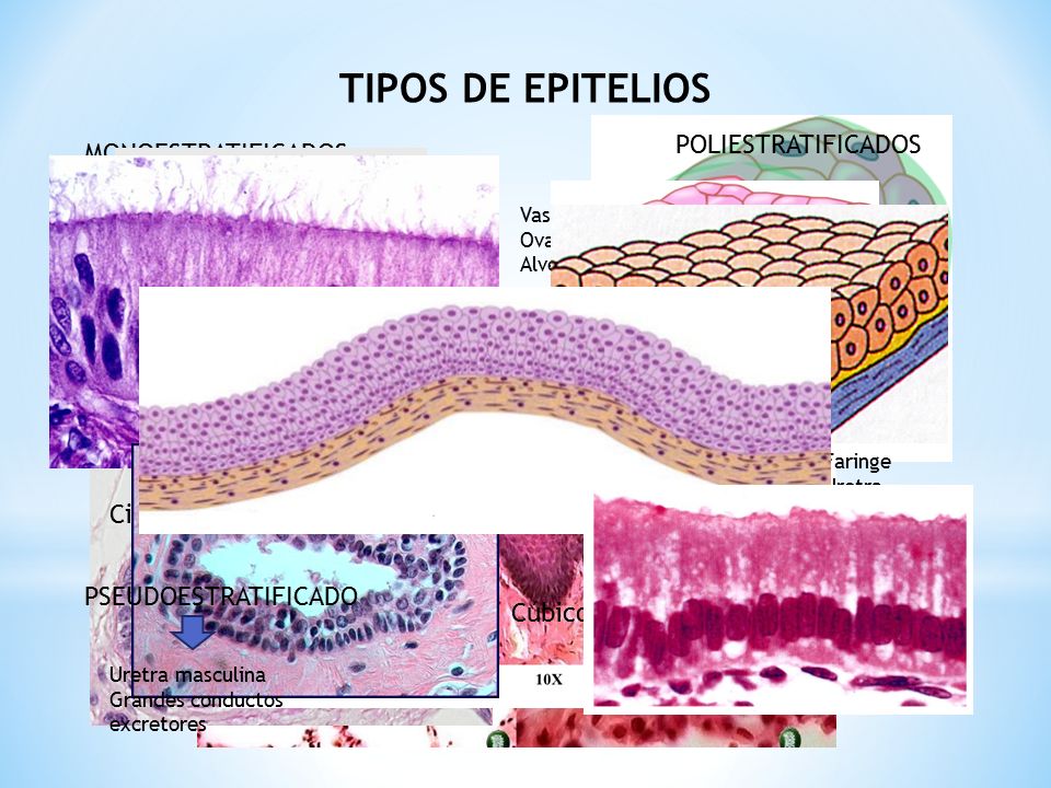 TIPOS DE EPITELIOS POLIESTRATIFICADOS MONOESTRATIFICADOS Queratinizado