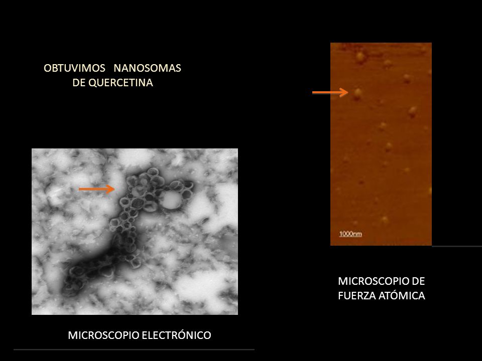 OBTUVIMOS NANOSOMAS DE QUERCETINA MICROSCOPIO DE FUERZA ATÓMICA MICROSCOPIO ELECTRÓNICO